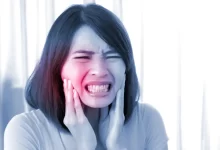 درد بعد از کشیدن دندان عقل چقدر طول میکشد