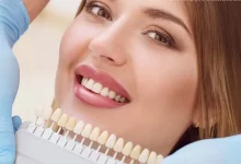 لمینت دندان سرامیکی یا کامپوزیتی