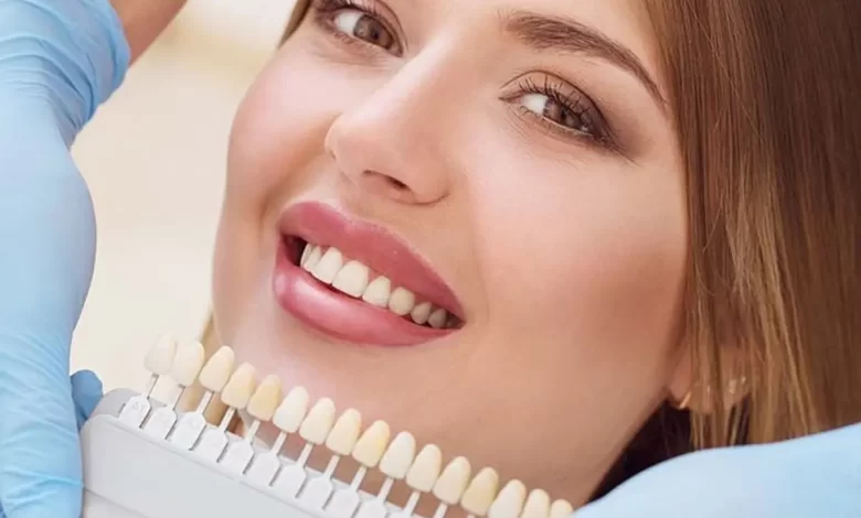 لمینت دندان سرامیکی یا کامپوزیتی