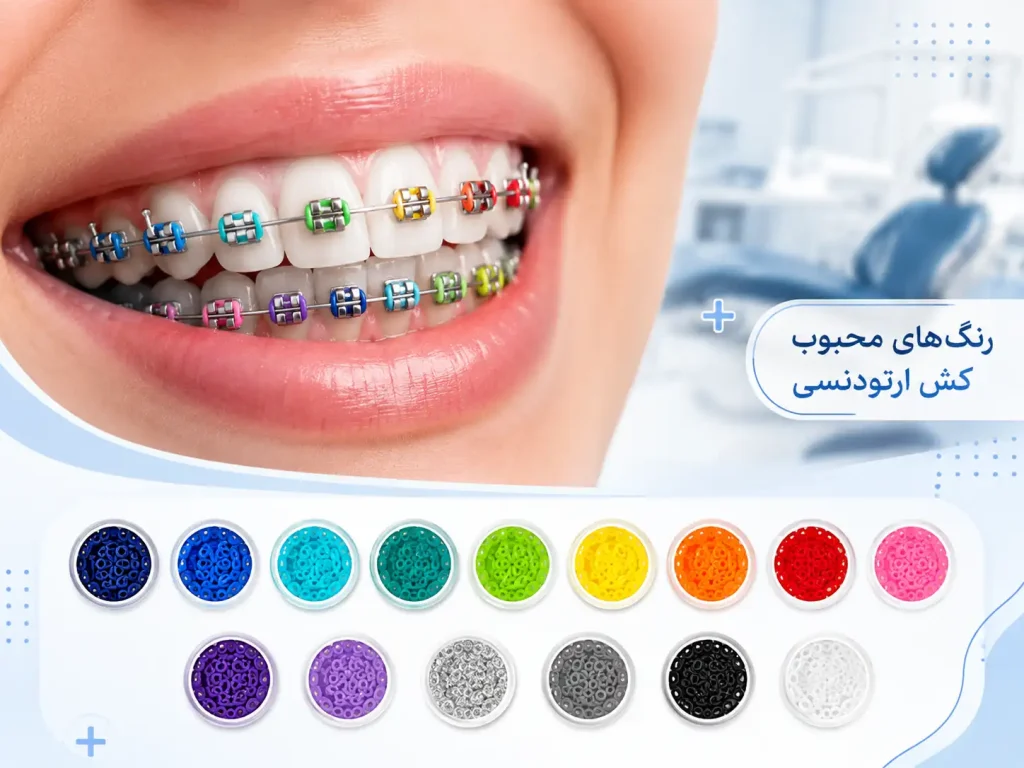 رنگ کش های ارتودنسی
