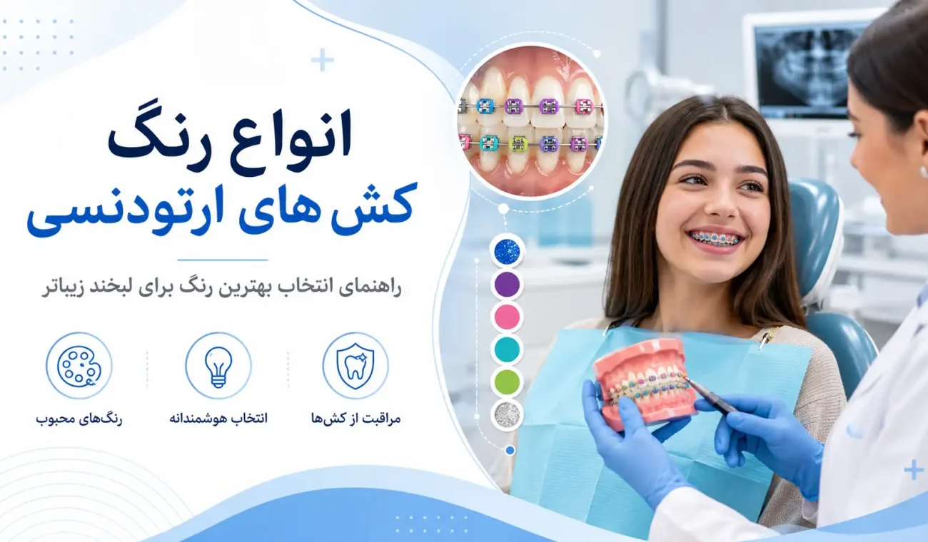انواع رنگ کش های ارتودنسی؛ راهنمای انتخاب بهترین رنگ برای لبخند زیباتر