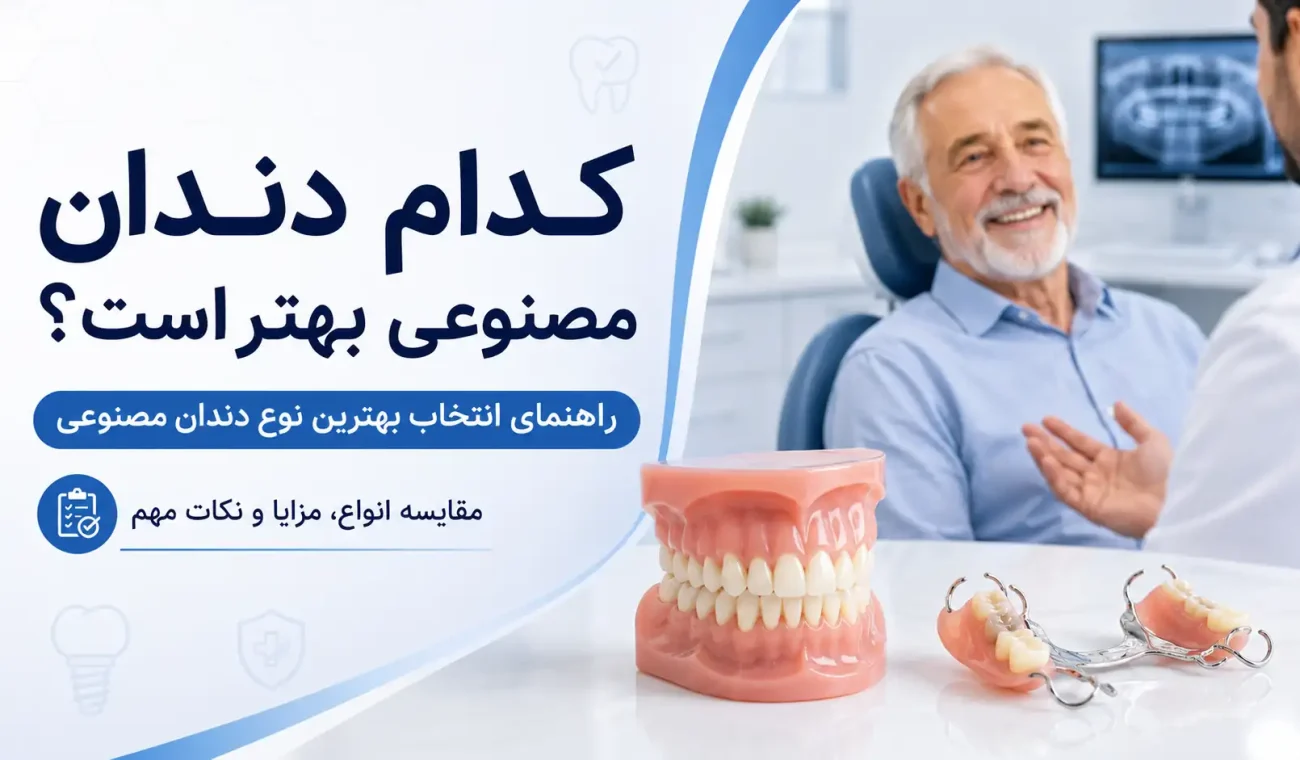 کدام دندان مصنوعی بهتر است؟ راهنمای انتخاب بهترین نوع دندان مصنوعی