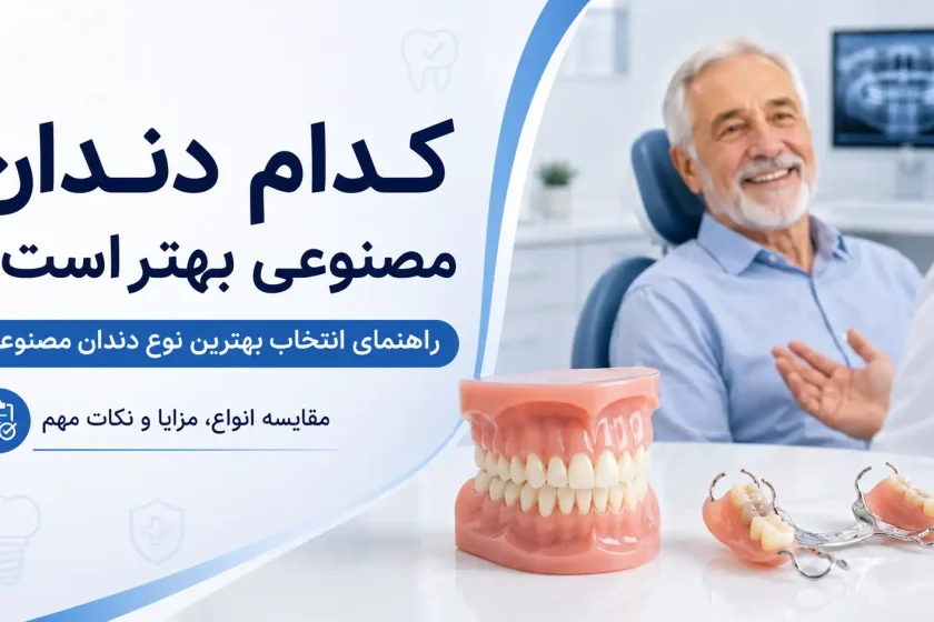 کدام دندان مصنوعی بهتر است؟ راهنمای انتخاب بهترین نوع دندان مصنوعی