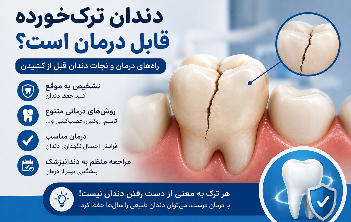 دندان ترک‌خورده قابل درمان است؟ راهنمای نجات دندان قبل از اینکه دیر شود