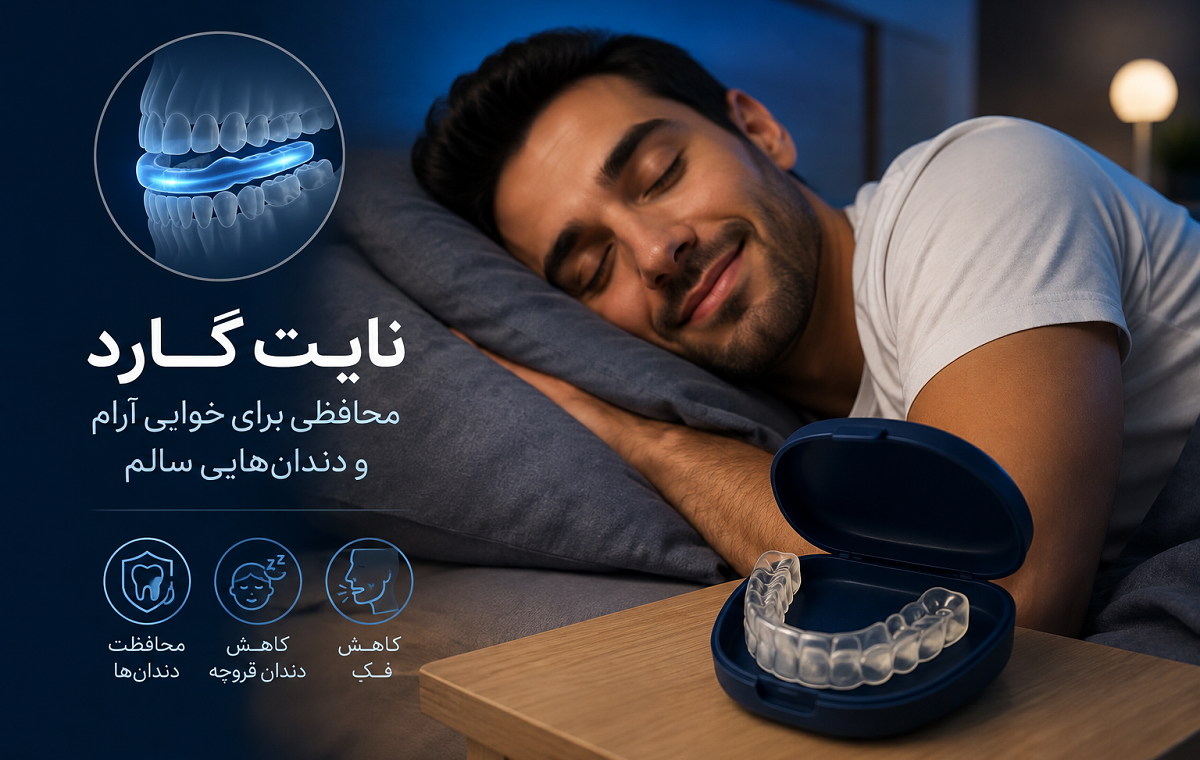 نایت گارد چیست؟ کاربرد، انواع، مزایا و نحوه استفاده از محافظ شبانه دندان