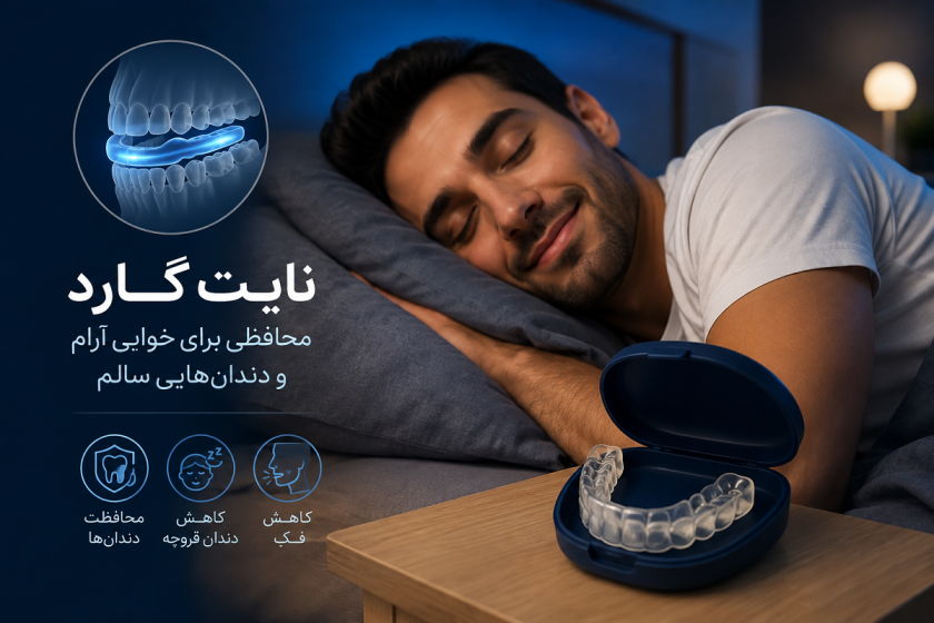 نایت گارد چیست؟ کاربرد، انواع، مزایا و نحوه استفاده از محافظ شبانه دندان