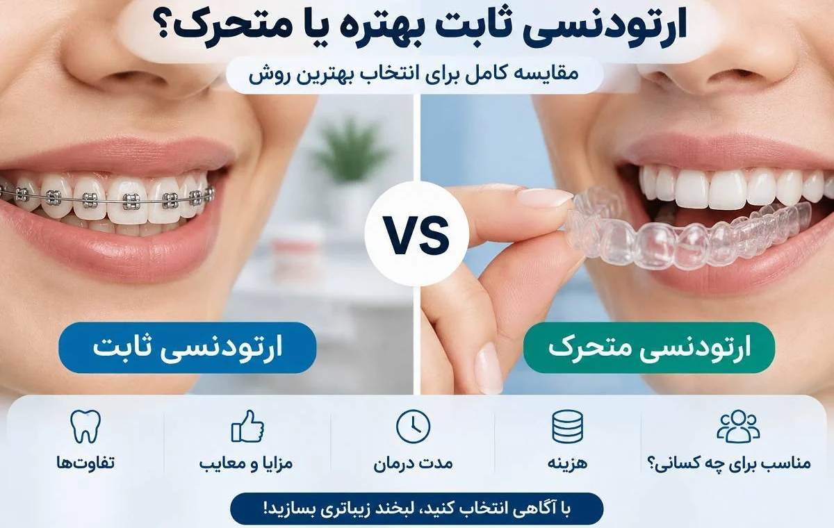 مقایسه کامل ارتودنسی ثابت و متحرک؛ کدام یک دندان‌ها را بهتر صاف می‌کند؟