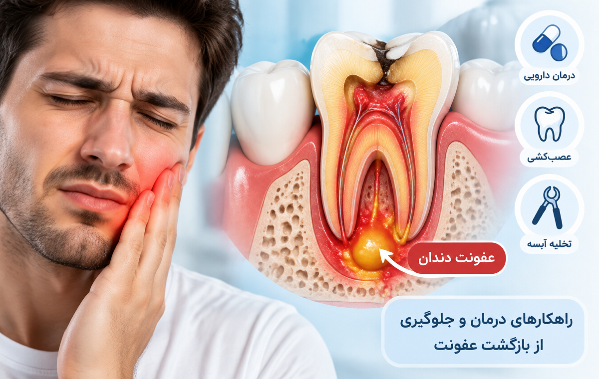 چگونه عفونت دندان را خارج کنیم؟ روش‌های موثر درمان و تخلیه عفونت دندان