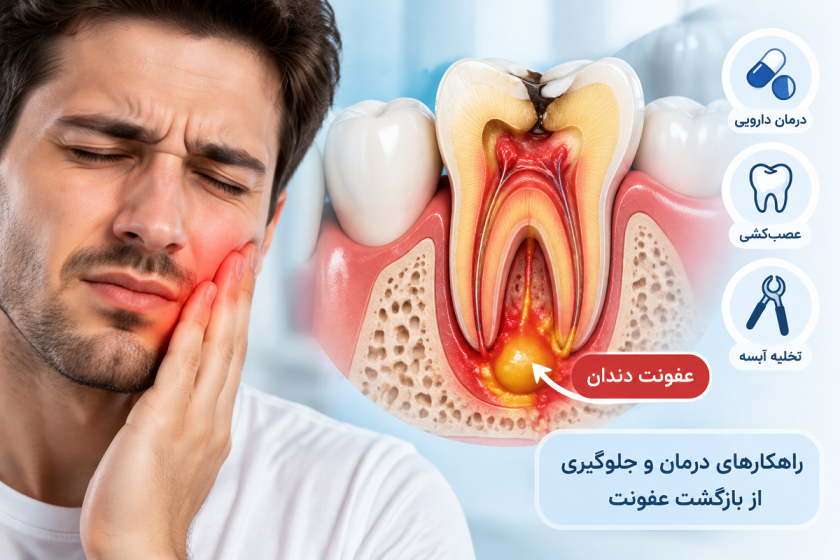 چگونه عفونت دندان را خارج کنیم؟ روش‌های موثر درمان و تخلیه عفونت دندان