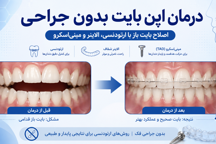 درمان اپن بایت بدون جراحی؛ آیا می‌توان بایت باز را بدون جراحی فک اصلاح کرد؟