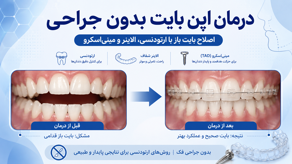 درمان اپن بایت بدون جراحی؛ آیا می‌توان بایت باز را بدون جراحی فک اصلاح کرد؟