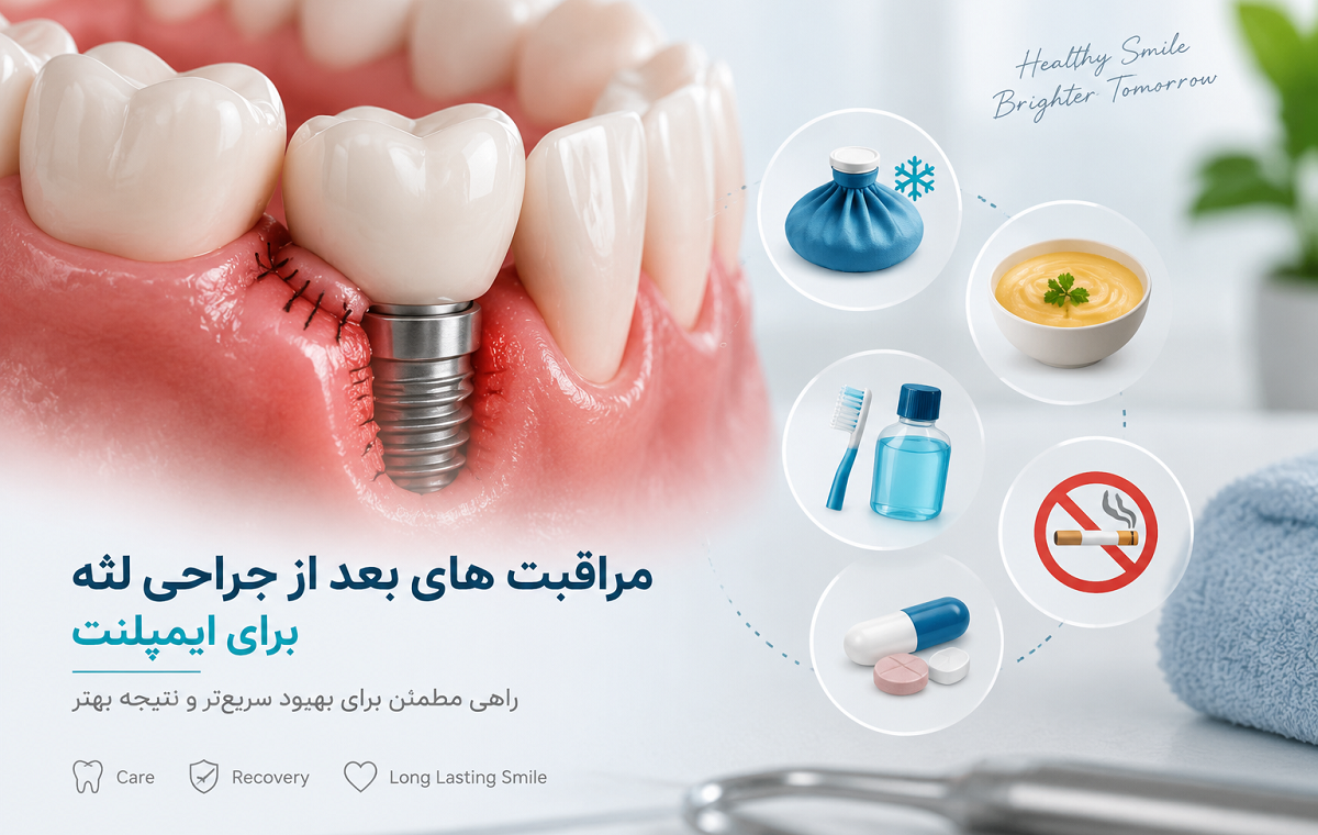 مراقبت های بعد از جراحی لثه برای ایمپلنت چیست؟ راهنمای کامل بهبود سریع‌تر
