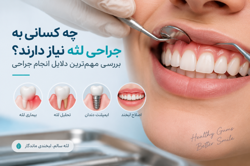 چه کسانی به جراحی لثه نیاز دارند؟ بررسی مهم‌ترین دلایل انجام جراحی