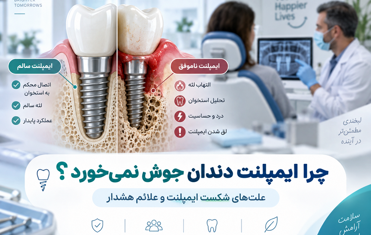 چرا ایمپلنت دندان جوش نمی‌خورد؟ دلایل شکست ایمپلنت و علائم هشدار