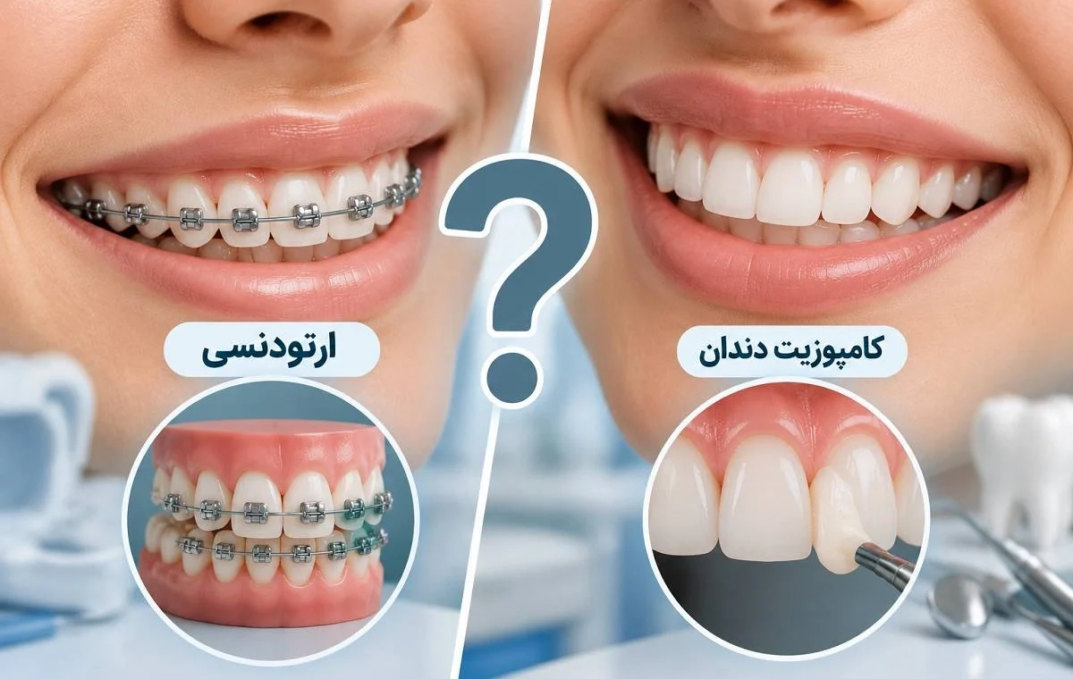 ارتودنسی یا کامپوزیت دندان؟ قبل از انتخاب این تفاوت‌های مهم را بدانید