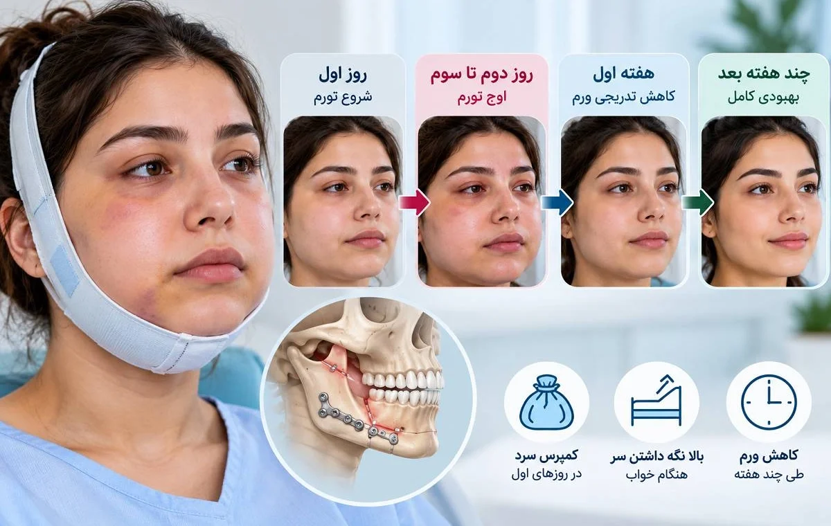 چند روز بعد از جراحی فک ورم کم می‌شود؟ از اوج تورم تا بهبودی کامل