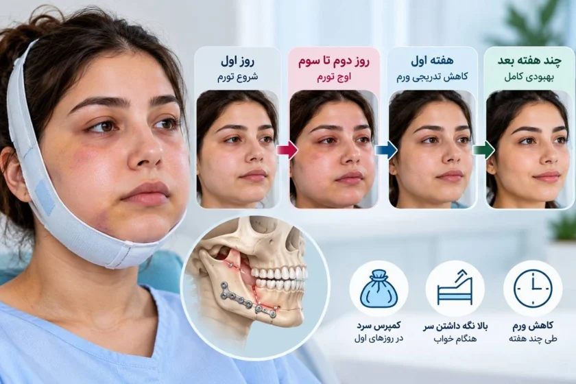 چند روز بعد از جراحی فک ورم کم می‌شود؟ از اوج تورم تا بهبودی کامل