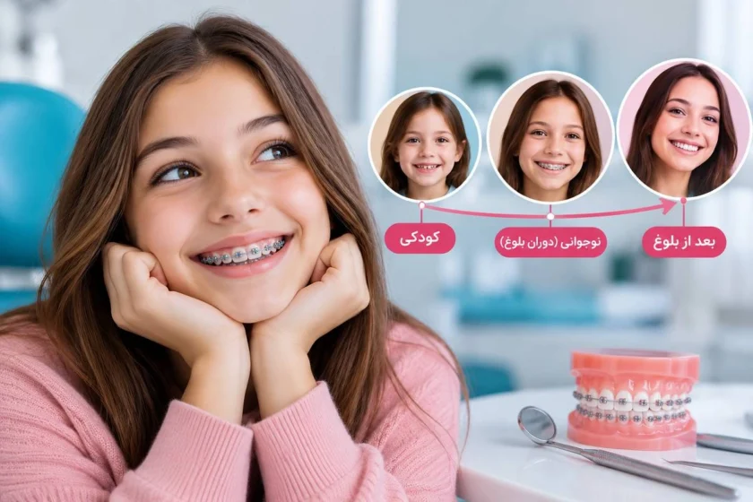 بهترین سن ارتودنسی برای دختران؛ قبل از بلوغ یا بعد از آن؟